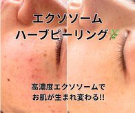 イロドリ(irodori)