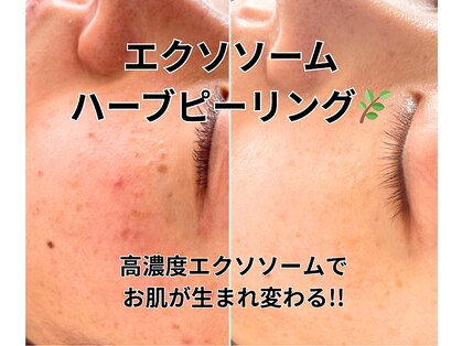 イロドリ(irodori)の写真