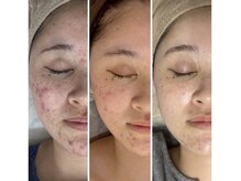 アンリミット 鹿児島天文館店(Une limit)/