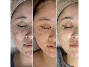 アンリミット 鹿児島天文館店(Une limit)/