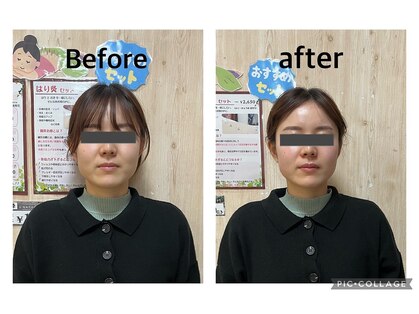まごころ整骨院の写真