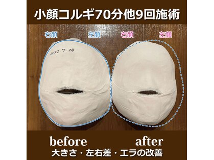 エスク(ESQUE)の写真