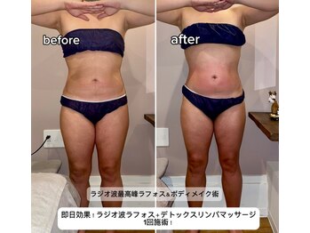 久遠(kuon)/お腹周り腰回り脂肪を大燃焼!