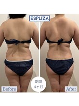 エスプライザ 鹿児島天文館店(ESPLIZA)/