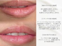フォンビューティー(fon beauty)の雰囲気（話題のローマピンク導入！[黒ずみ/メラニン除去/中野駅]）