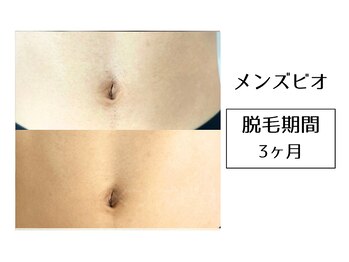 メンズビオ 神戸三宮店/