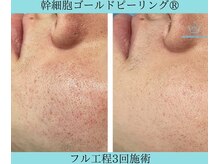 リメイククリニカルビューティー(Remake clinical beauty)/