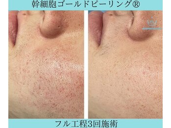 リメイククリニカルビューティー(Remake clinical beauty)/