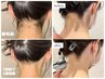 【3月限定,5名様】よく髪を上げる方に☆うなじ脱毛で後ろ姿も美人へ!残り2名