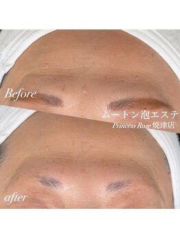 キレイシェア バイ プリンセスローズ静岡駅店(KIREI SHARE)/ムートン泡エステ