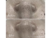 シェーン(Schon)