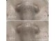 シェーン(Schon)の写真