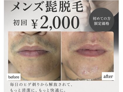 エレーヴ(Eleve)の写真