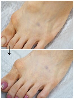 ネイル キャンバス シルヴァ(Nail Canvas Silva.)/フットも光エステにお任せ!