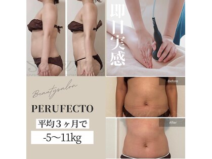 ペルフェクト(PERFECTO)の写真