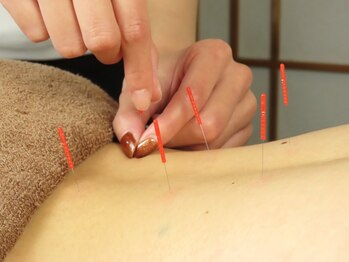 サンクエール 代官山鍼灸院(CINQ AILES)/鍼灸施術
