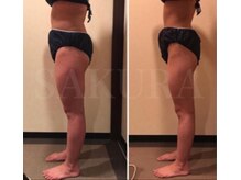 エステティックサロン サクラ(SAKURA)/セル・皮下・内臓脂肪を撃退！