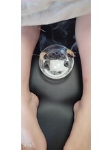 創整はりきゅう院/ツボに鍼を刺してお灸で温めます