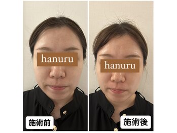 ハヌル(hanuru)/小顔ボディ　(hanuru式美容整体)