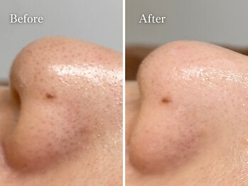 エリー(Ellie)/至近距離でも怖くない