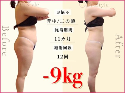 痩身エステ 美容整体 ドクタースタイル(Dr.Style)の写真