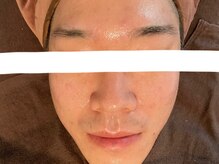 リセットプラス(Reset+)/