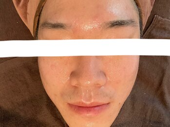 リセットプラス(Reset+)/