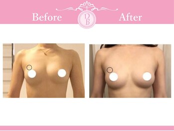 デミーナ(Demyna)/