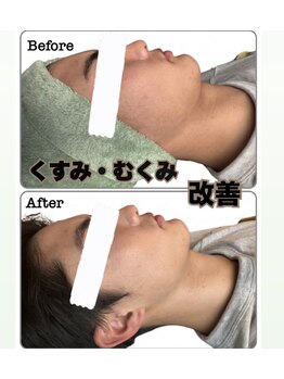 シオナ(Siona)/メンズフェイシャル