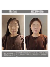 ヴェリタス(VERITAS)/疲れ顔を卒業