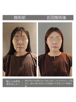 ヴェリタス(VERITAS)/疲れ顔を卒業