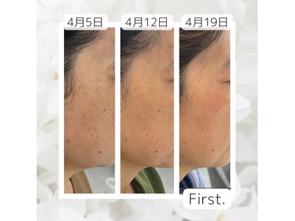 ファースト(First.)の写真