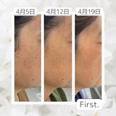 ファースト(First.)