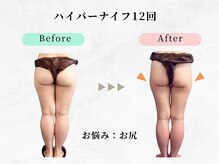 ウェリナ平和堂長久手院/小顔矯正/骨盤矯正/痩身/整体