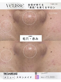 ヴェリス 福岡店(Velisse)/