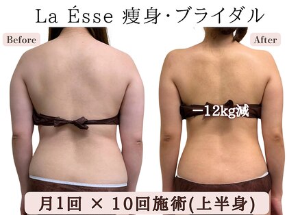 ラエッセ(La Esse)の写真