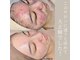 ラ ラナン(La lanun)の写真/繰り返すニキビを根本から直接殺菌☆