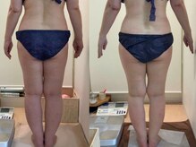 カブール 町田店/59歳♪脚ほっそり☆町田/痩身