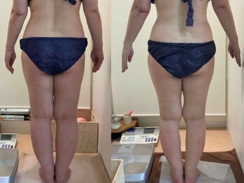 カブール 町田店/59歳♪脚ほっそり☆町田/痩身