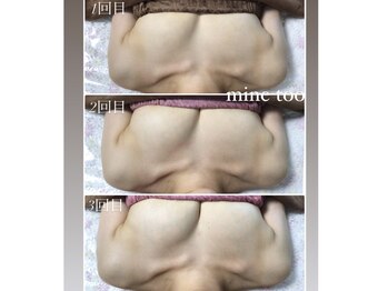 マイントゥー(mine too)/回数を重ねてしっかりバストUP！