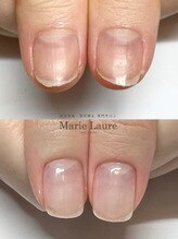 マリーロール 梅田店(Marie Laure)/自爪育成/深爪矯正/ネイルケア