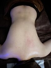 ネスト(nest)/ミュスクルリンパトリートメント