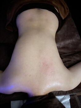 ネスト(nest)/ミュスクルリンパトリートメント