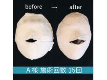 プレジールの雰囲気（コルギ施術の後は当サロン独自配合ミネラルプラセンタ石膏パック）