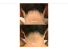 ビューティーサロンレモン(Lemon)の雰囲気（うなじWaxで後ろ姿も美人に！WAXxxx使用☆スピケア正規取扱店）