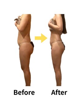 ムーロ(muro.)/Before After