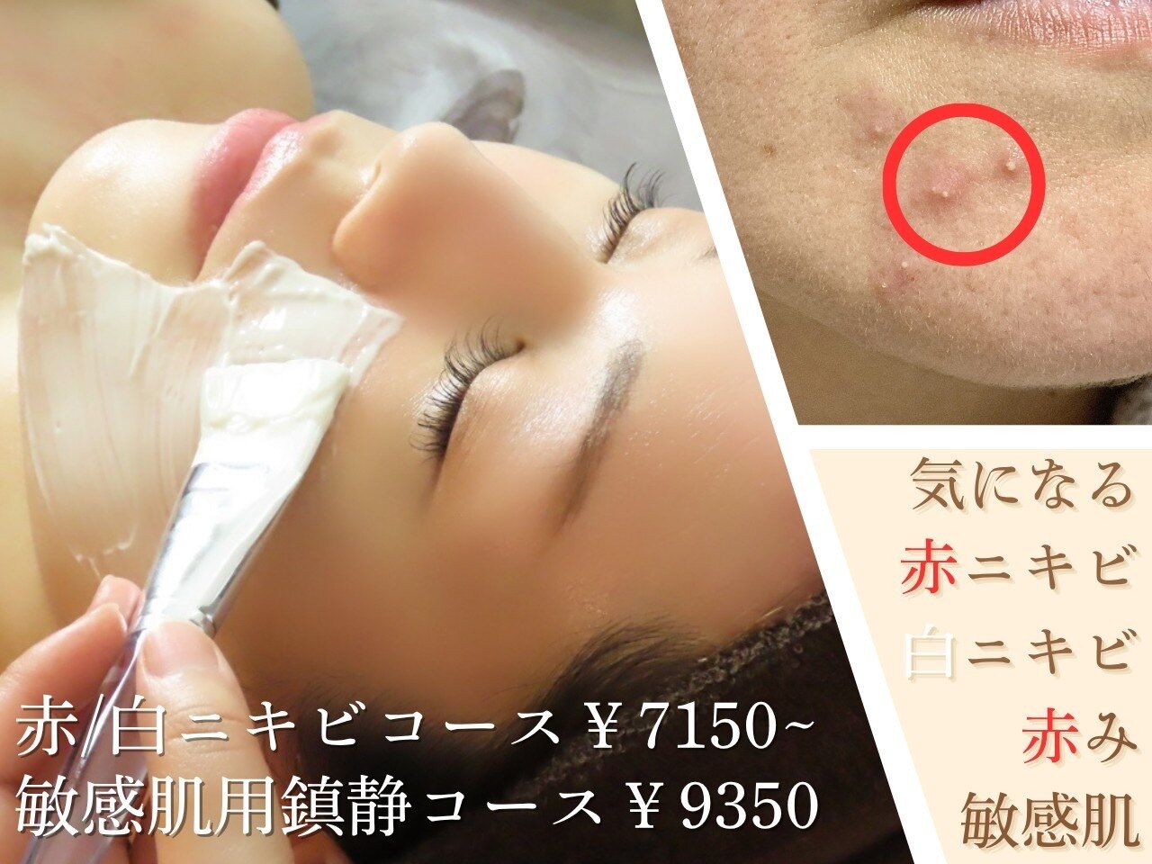 札幌市中央区でEMSが人気のエステサロン｜ホットペッパービューティー