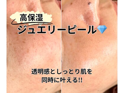 イロドリ(irodori)の写真