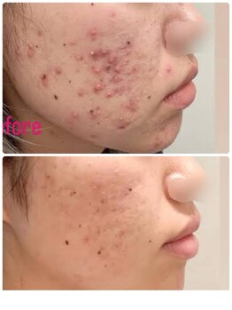 スリリアン 銀座/★お客さまビフォーアフター★