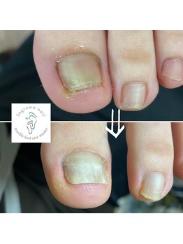 ガチガチ・ぎゅーっと痛い。。。